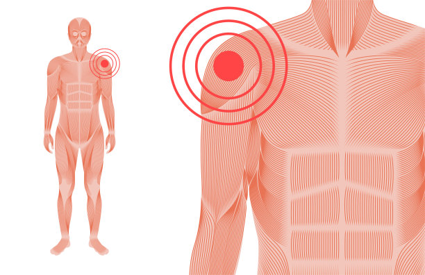 肩痛的概念图片下载