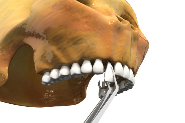 拔掉生病的牙齿。三维演示图片下载
