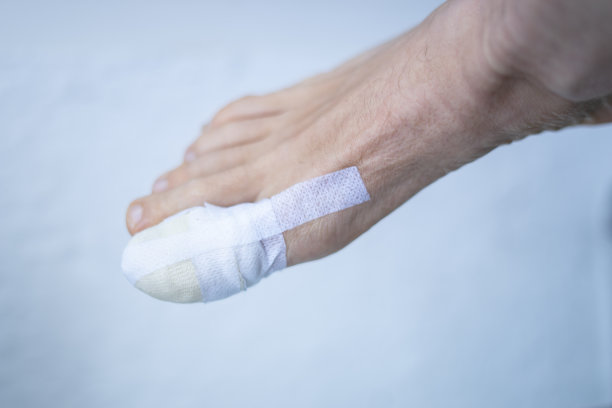 脚部大脚趾包扎受伤的脚部在医疗临床中心医院。图片下载