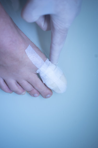 脚部大脚趾包扎受伤的脚部在医疗临床中心医院。图片下载