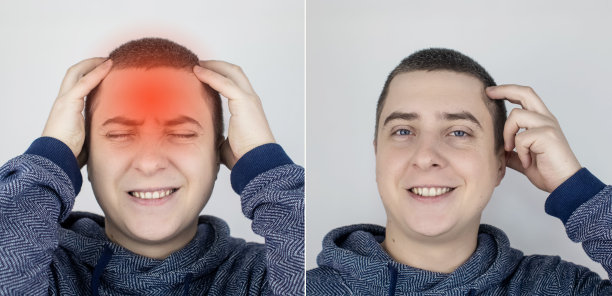 之前和之后。左边的男人表示头痛，右边表示头不再疼了。医疗保健的概念在治疗偏头痛和高血压图片下载