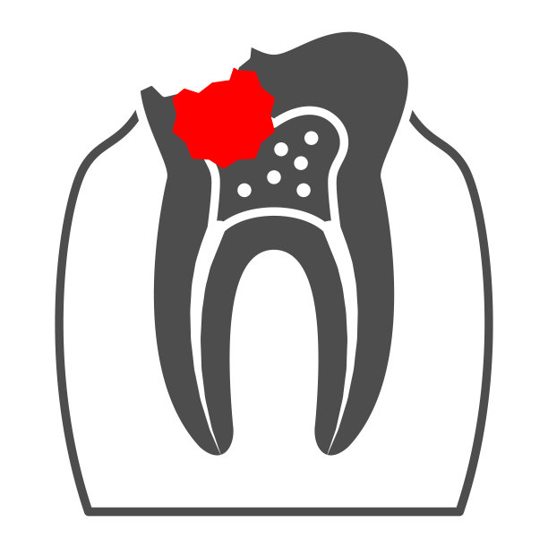 龋齿固体图标，人类疾病概念，牙齿炎症标志上的白色背景，龋齿图标在象形风格的移动概念和网页设计。矢量图形。图片下载