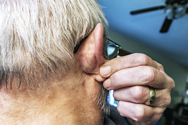 老年男子显示皮肤状况后耳图片下载