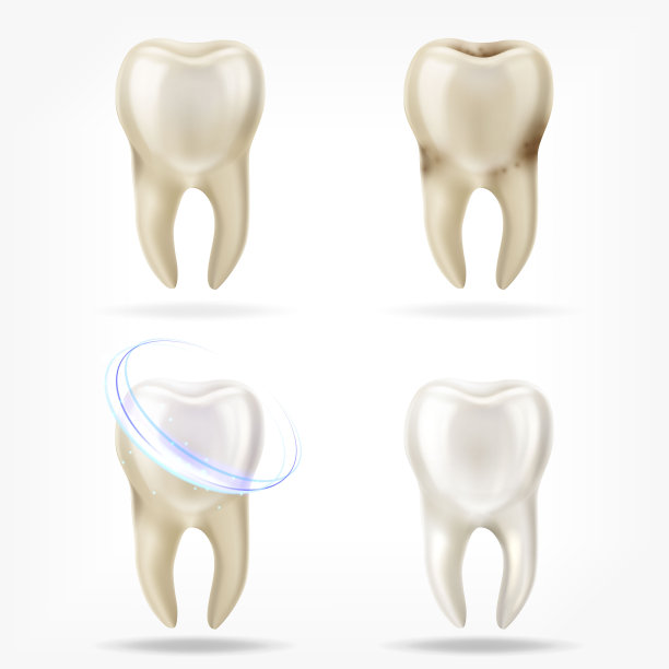 三维现实的清洁和脏牙向量集，清除牙齿的过程。口腔护理，牙齿修复图片下载