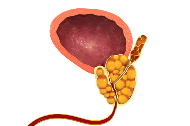 膀胱癌症。三维演示图片下载