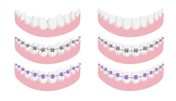 下颌有健康的牙齿和牙箍图片下载
