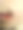 一个少年的嘴与单纯疱疹的特写图片下载