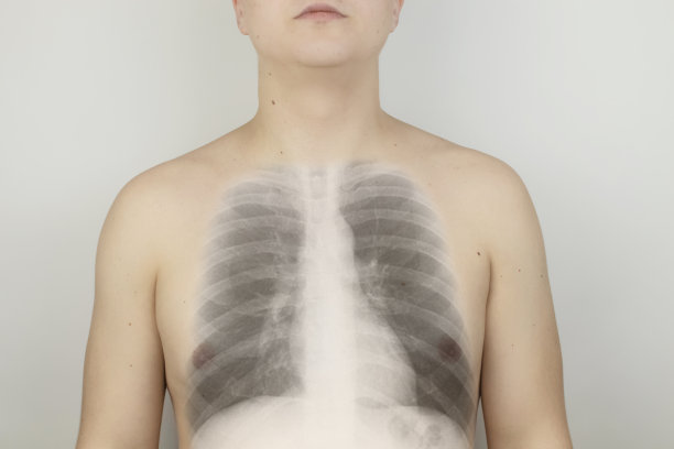 概念上的照片。男性胸部x光片。病人背部皮肤上出现了肋骨和肺部的图像。透过皮肤观察骨骼。灰色背景上的孤立男子。图片下载