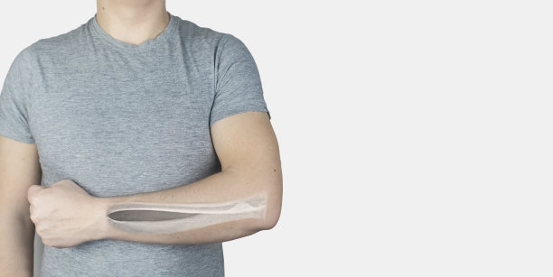 概念上的照片。一个男人的前臂x光片。患者手部皮肤上出现尺骨和桡骨的图像。透过皮肤观察骨骼。灰色背景上的孤立男子。图片下载