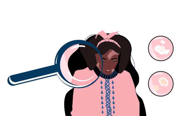 白癜风的概念。放大镜可以放大皮肤病。皮肤颜色的局部丧失。带有自身免疫疾病症状和体征的信息图表图标向量横幅图片下载