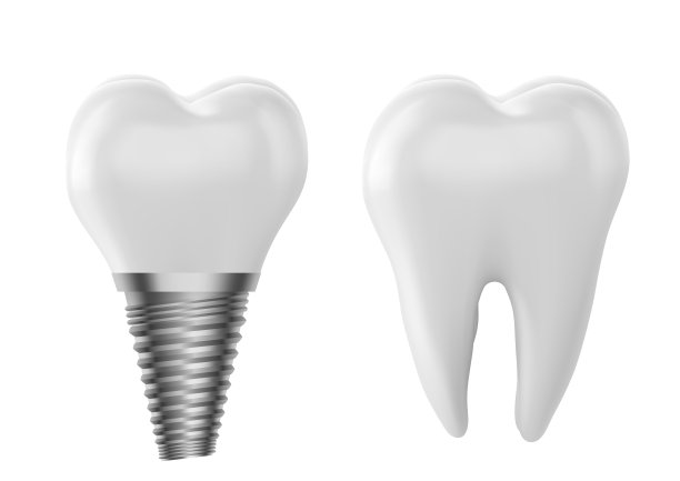 一颗牙齿的牙齿模型，作为牙齿检查概念的插图，牙齿的健康和卫生。图片下载