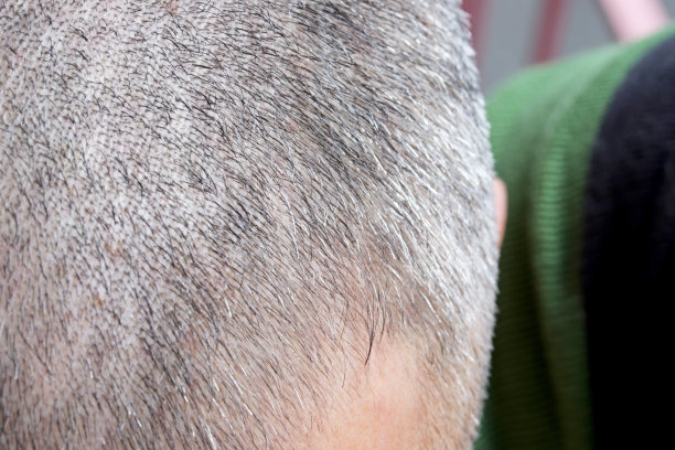 男性头发的特写图片下载