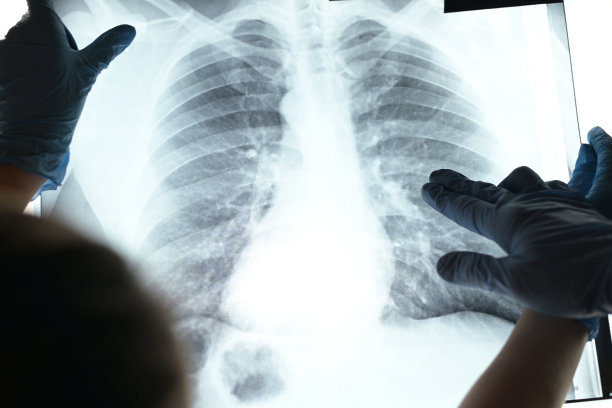 医生戴着医用手套进行肺部x光检查图片下载