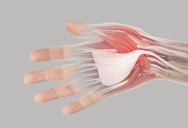 肌肉的手疼痛图片下载