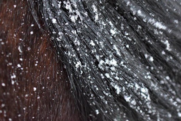 一个棕色的马的头，闭着眼睛作为一个近距离的肖像图片下载