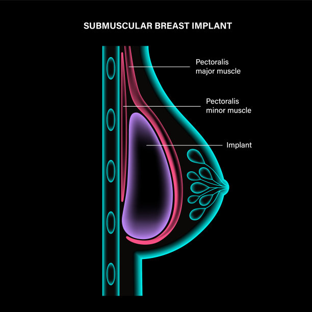 乳房植入物的概念图片下载