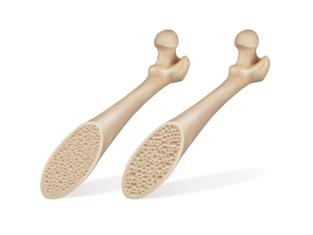 医学上健康的骨头和病人的骨头图片下载