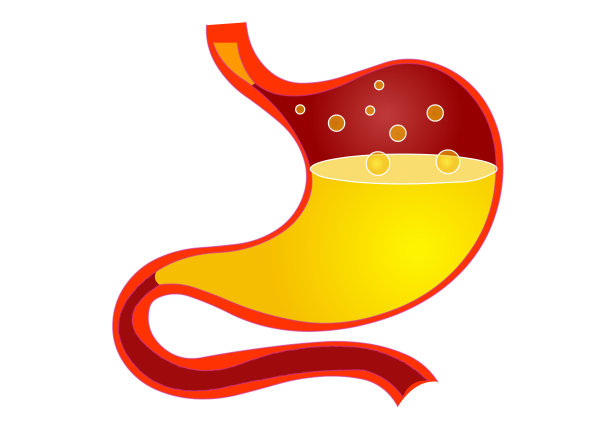 胃解剖图标。消化系统器官剖面图。红色的物体，黄色的液体，气泡。胃疾病。医学图形画出来。说明向量图片下载