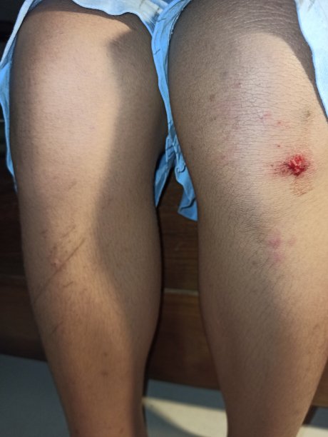 取消了男孩的膝盖图片下载