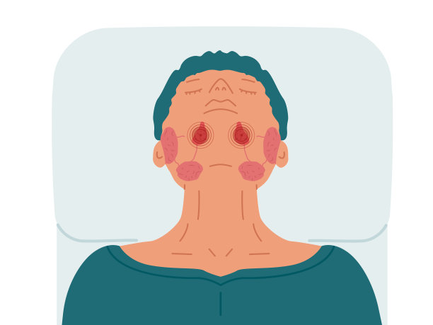 一个患有舌下唾液腺病变的病人。涎石病的载体说明。图片下载