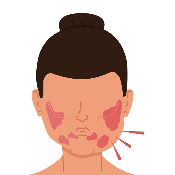 涎腺发炎的女人。医疗矢量插图。图片下载