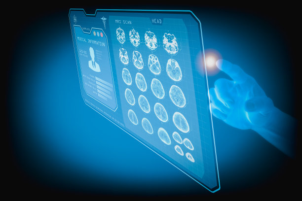 手指指着一个屏幕，屏幕上显示着病人的3D健康检查结果。核磁共振成像图片下载