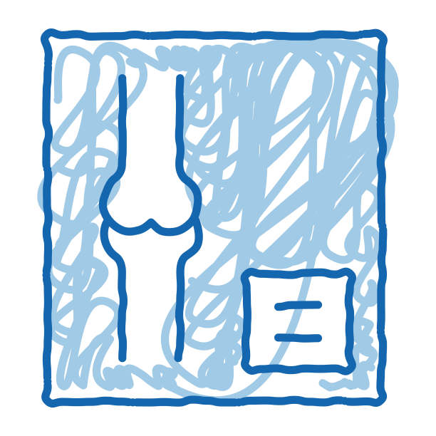人体关节骨x线图像骨科矢量图片下载
