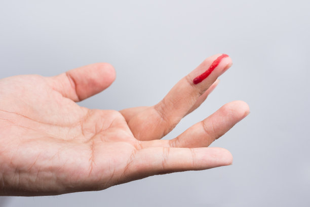 手指的伤口在流血。手指受伤流血图片下载