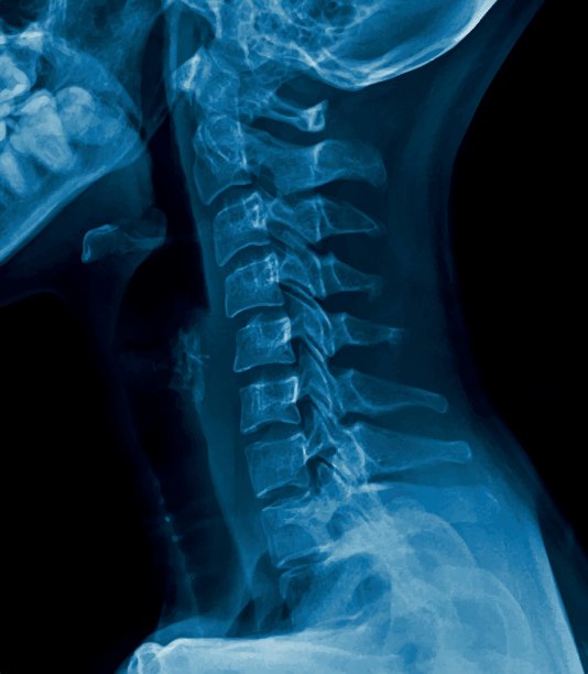 x射线人类脖子图片下载