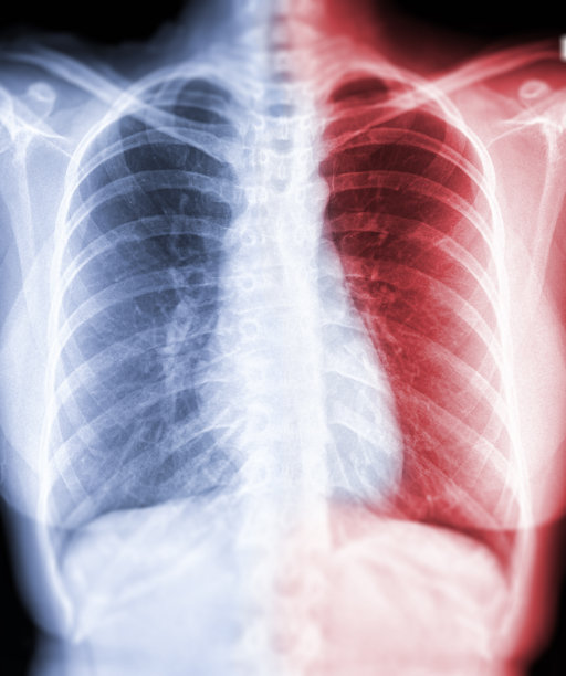 胸部x线或人体胸部x线图像查看检测结核病(TB)和冠状病毒2019的蓝色和红色区域。图片下载