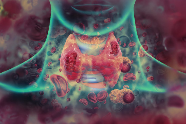 甲状腺癌症。显示甲状腺伴肿瘤。三维演示图片下载