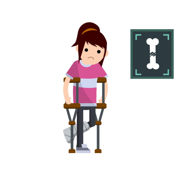 一个断了一条腿和拐杖的女人。医疗服务。创伤病人。绷带的脚。穿粉红色衣服的女孩。卡通平面插图。射线照片的分析。在骨裂图片下载