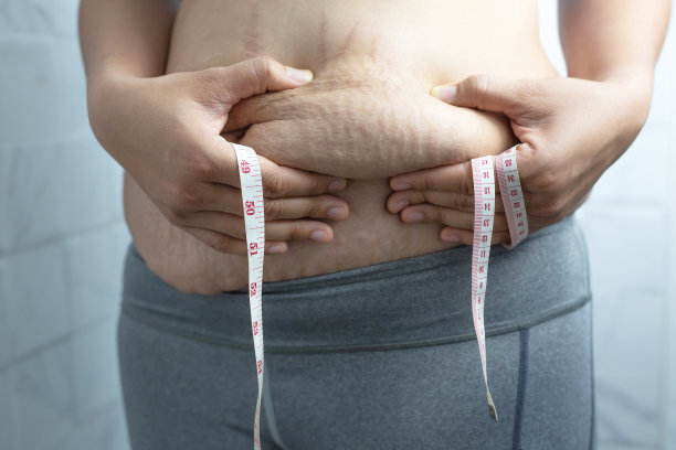 肥胖的女人需要控制体重，因为她有多余的脂肪。图片下载