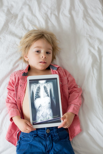 蹒跚学步的儿童，拿着儿童身体片上的x光照片和吞下的磁铁显示，儿童吞下危险物体图片下载