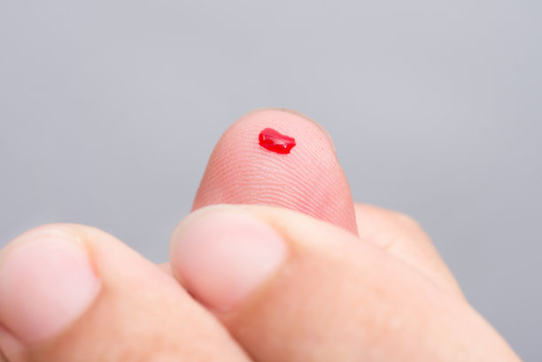 指尖滴血，准备检查血糖水平图片下载