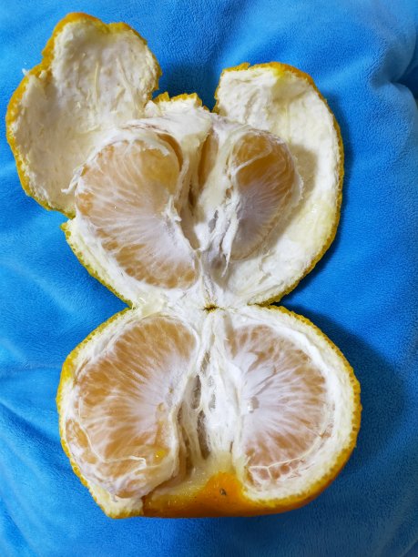 Remon公司图片下载