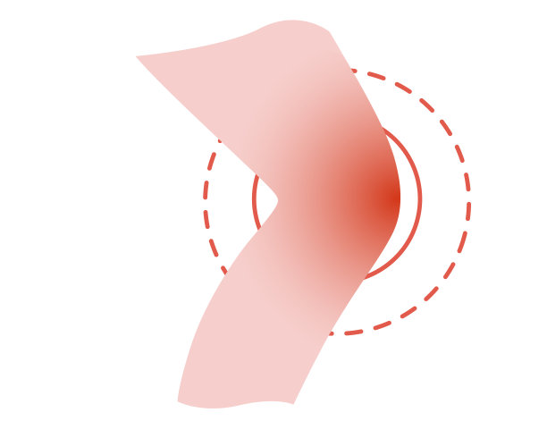 痛腿膝盖概念与痛红圆卡通平面设计矢量插图上的白色背景图片下载