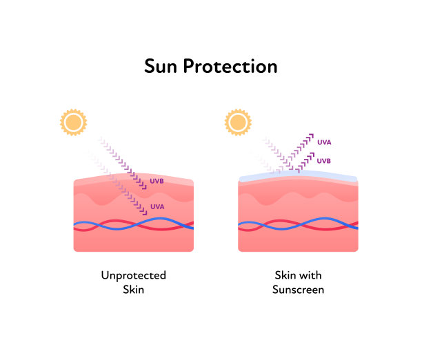 防晒医疗信息图表。矢量平面插图。皮肤层与uva和uvb箭头。涂上防晒霜却不加保护。专为化妆品行业和皮肤科设计。图片下载