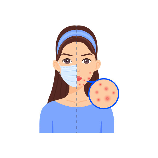 戴着医用口罩的迷人女孩。美丽的脸上的丘疹，因为戴了医用口罩。问题皮肤。单色卡通时尚风格。白色背景。矢量插图。图片下载