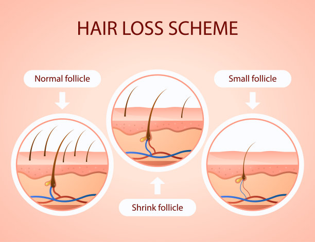 梯度脱发方案图片下载