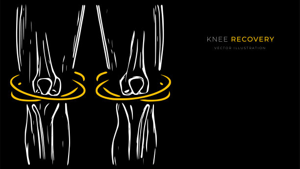 膝关节恢复的矢量图。创造性的医学海报或横幅。图片下载