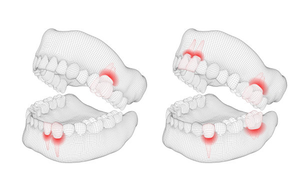 人类的下巴。三维向量的布局。医学和健康。牙齿疼痛。图片下载
