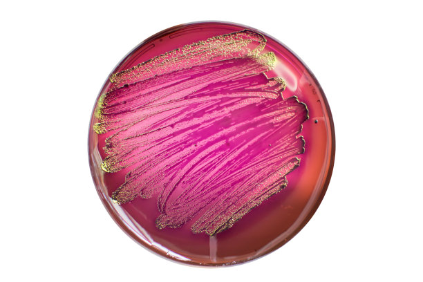 MacConkey琼脂培养基上的大肠杆菌菌落图片下载