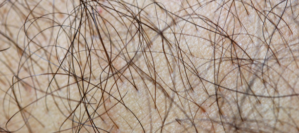 一个人的近臂毛发图片下载