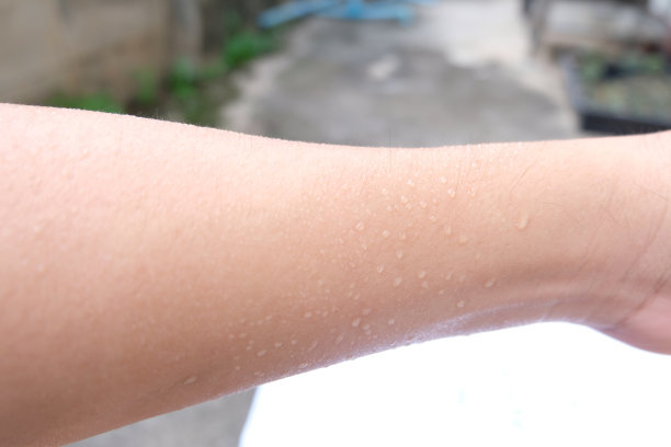 通过手臂上的毛孔出汗图片下载