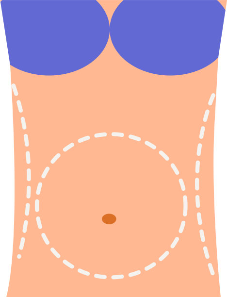 腹部整形手术组成图片下载