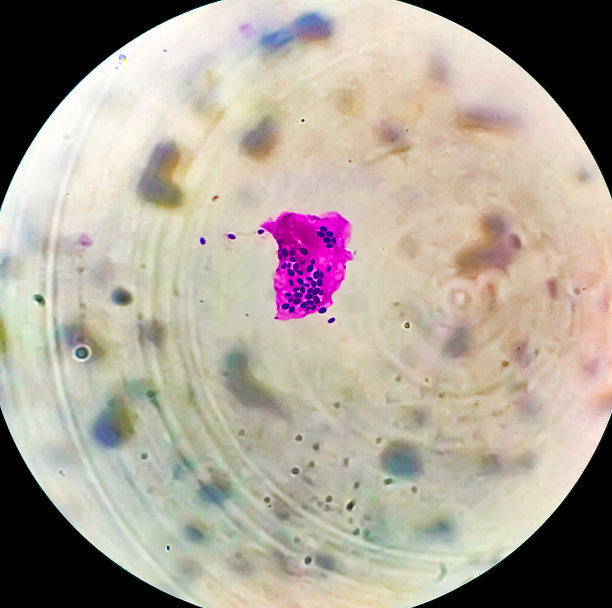 显微镜下的白色念珠菌。黑色的真菌图片下载