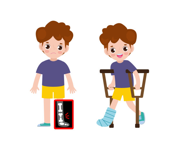 可爱的卡通亚洲儿童腿骨折，x光片，用石膏和拐杖恢复。儿童骨折治疗。孤立在白色背景矢量插图图片下载