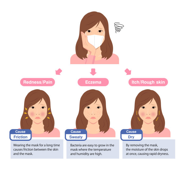 矢量插图皮肤问题造成的戴口罩。图片下载