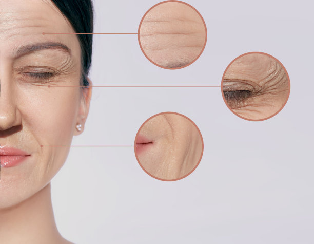 皱纹，衰老的前额，鼻唇沟和眼睛周围。老年性皮肤变化图片下载